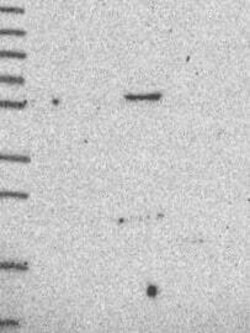 MARCH1 Antibody, Novus Biologicals 100 &mu;L, Unconjugated:Antibodies,