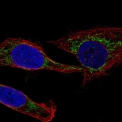 MCCC1 Antibody, Novus Biologicals 100 &mu;L, Unconjugated:Antibodies, Polyclonal