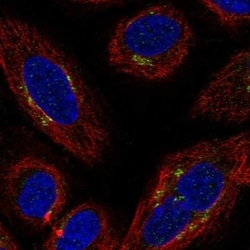 MDS028 Antibody, Novus Biologicals 100 &mu;L, Unconjugated:Antibodies,