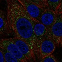 MTMR1 Antibody, Novus Biologicals 100 &mu;L, Unconjugated:Antibodies, Polyclonal