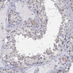 MUM1 Antibody, Novus Biologicals 100 &mu;L, Unconjugated:Antibodies, Polyclonal