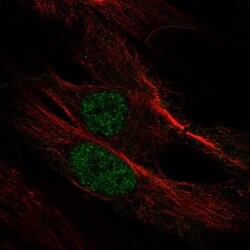 MYF6 Antibody, Novus Biologicals 100 &mu;L, Unconjugated:Antibodies, Polyclonal