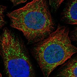 NDUFAF4 Antibody, Novus Biologicals 100 &mu;L, Unconjugated:Antibodies,