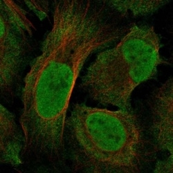 Neurofibromin 1 Antibody, Novus Biologicals 100 &mu;L, Unconjugated:Antibodies,