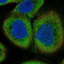 NT5C3 Antibody, Novus Biologicals 100 &mu;L, Unconjugated:Antibodies, Polyclonal