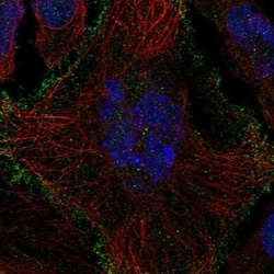 OATP1B1/OATP2 Antibody, Novus Biologicals 100 &mu;L, Unconjugated:Antibodies,