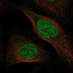 OSGEP Antibody, Novus Biologicals 100 &mu;L, Unconjugated:Antibodies, Polyclonal