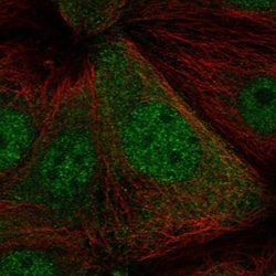 PBOV1 Antibody, Novus Biologicals 100 &mu;L, Unconjugated:Antibodies, Polyclonal