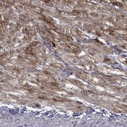 PGD2 Synthase/PTGDS Antibody, Novus Biologicals 100 &mu;L, Unconjugated:Antibodies,