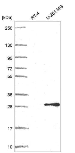 POP4 Antibody, Novus Biologicals 100 &mu;L, Unconjugated:Antibodies, Polyclonal