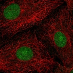 POP4 Antibody, Novus Biologicals 100 &mu;L, Unconjugated:Antibodies, Polyclonal