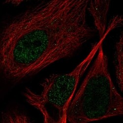 PPP1R3F Antibody, Novus Biologicals 100 &mu;L, Unconjugated:Antibodies,