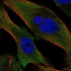 PPP3CC Antibody, Novus Biologicals 100 &mu;L, Unconjugated:Antibodies,
