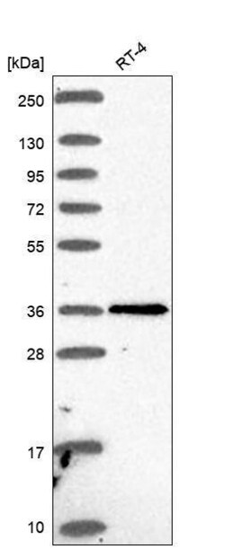 PTGDR Antibody, Novus Biologicals 100 &mu;L, Unconjugated:Antibodies, Polyclonal