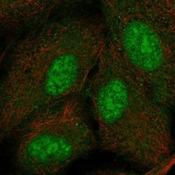 PYDC2 Antibody, Novus Biologicals 100 &mu;L, Unconjugated:Antibodies, Polyclonal