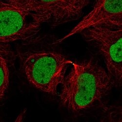 Rad21 Antibody, Novus Biologicals 100 &mu;L, Unconjugated:Antibodies, Polyclonal
