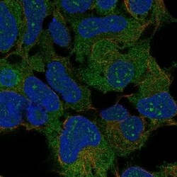RPLP2 Antibody, Novus Biologicals 100 &mu;L, Unconjugated:Antibodies, Polyclonal