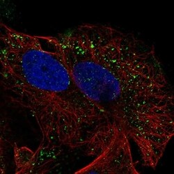 SEMA3D Antibody, Novus Biologicals 100 μL, Unconjugated:Antibodies,