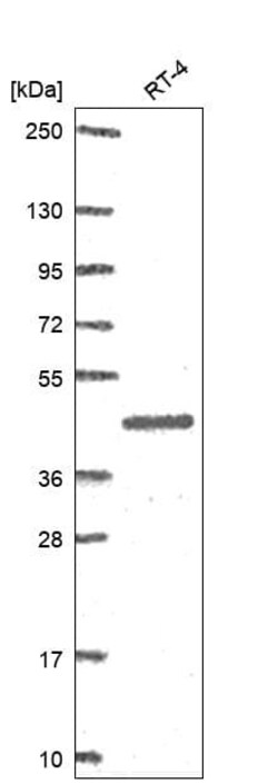 SerpinB2 Antibody, Novus Biologicals 100 &mu;L, Unconjugated:Antibodies,