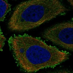 SLC20A1 Antibody, Novus Biologicals 100 &mu;L, Unconjugated:Antibodies,