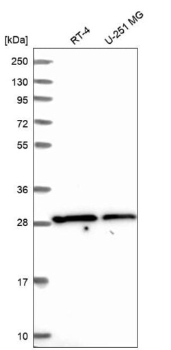 SLC25A45 Antibody, Novus Biologicals 100 &mu;L, Unconjugated:Antibodies,