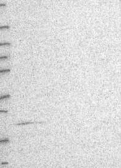 ST6 Sialyltransferase 6/ST6GALNAC6 Antibody, Novus Biologicals 100 &mu;L,