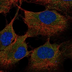 ST6 Sialyltransferase 6/ST6GALNAC6 Antibody, Novus Biologicals 100 &mu;L,