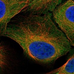 STRA8 Antibody, Novus Biologicals 100 &mu;L, Unconjugated:Antibodies, Polyclonal