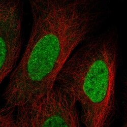 SUV420H2 Antibody, Novus Biologicals 100 &mu;L, Unconjugated:Antibodies,