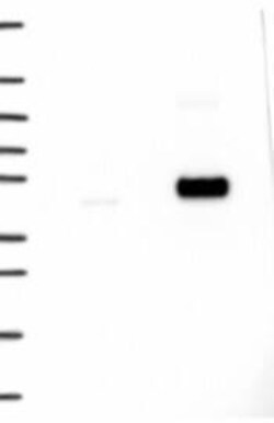 TBC1D13 Antibody, Novus Biologicals 100 &mu;L, Unconjugated:Antibodies,