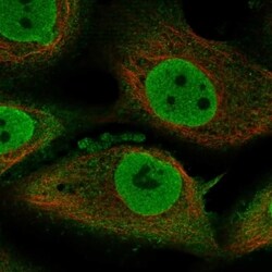 Teneurin-1 Antibody, Novus Biologicals 100 &mu;L, Unconjugated:Antibodies,