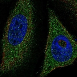 TFEB Antibody, Novus Biologicals 100 &mu;L, Unconjugated:Antibodies, Polyclonal