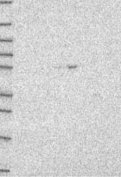 TFEB Antibody, Novus Biologicals 100 &mu;L, Unconjugated:Antibodies, Polyclonal
