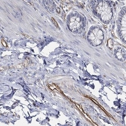THSD1 Antibody, Novus Biologicals 100 &mu;L, Unconjugated:Antibodies, Polyclonal