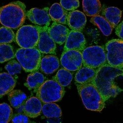 UBASH3B/STS1/Tula-2 Antibody, Novus Biologicals 100 &mu;L, Unconjugated:Antibodies,