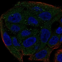UGT1A6 Antibody, Novus Biologicals 100 &mu;L, Unconjugated:Antibodies,