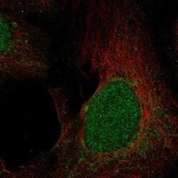 UNG Antibody, Novus Biologicals 100 &mu;L, Unconjugated:Antibodies, Polyclonal