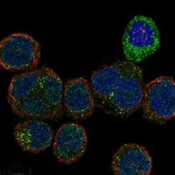 VEGFR2/KDR/Flk-1 Antibody, Novus Biologicals 100 &mu;L, Unconjugated:Antibodies,