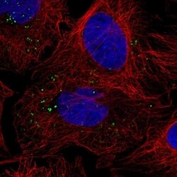 VPS25 Antibody, Novus Biologicals 100 &mu;L, Unconjugated:Antibodies, Polyclonal