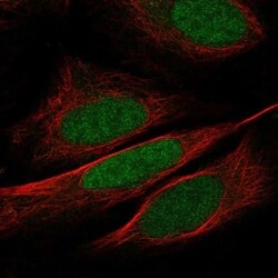 WDR5 Antibody, Novus Biologicals 100 &mu;L, Unconjugated:Antibodies, Polyclonal