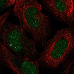 ZFP112 Antibody, Novus Biologicals 100 &mu;L, Unconjugated:Antibodies,