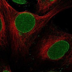 ZNF20 Antibody, Novus Biologicals 100 &mu;L, Unconjugated:Antibodies, Polyclonal