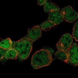 ZNF302 Antibody, Novus Biologicals 100 &mu;L, Unconjugated:Antibodies,