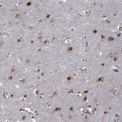 ZNF775 Antibody, Novus Biologicals 100 &mu;L, Unconjugated:Antibodies,