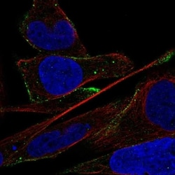 ADAMTS16 Antibody, Novus Biologicals 100 &mu;L, Unconjugated:Antibodies,