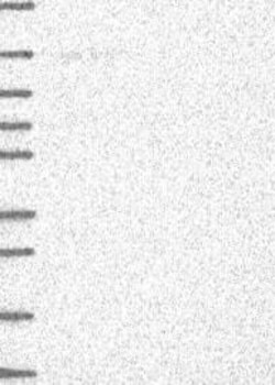 AF10 Antibody, Novus Biologicals 100 &mu;L, Unconjugated:Antibodies, Polyclonal