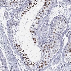AF10 Antibody, Novus Biologicals 100 &mu;L, Unconjugated:Antibodies, Polyclonal