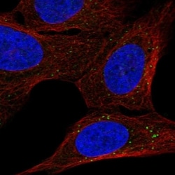 BBS2 Antibody, Novus Biologicals 100 &mu;L, Unconjugated:Antibodies, Polyclonal
