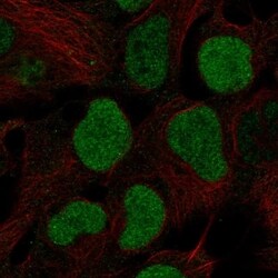 BRD2 Antibody, Novus Biologicals 100 &mu;L, Unconjugated:Antibodies, Polyclonal