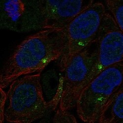 C1orf146 Antibody, Novus Biologicals 100 &mu;L, Unconjugated:Antibodies,